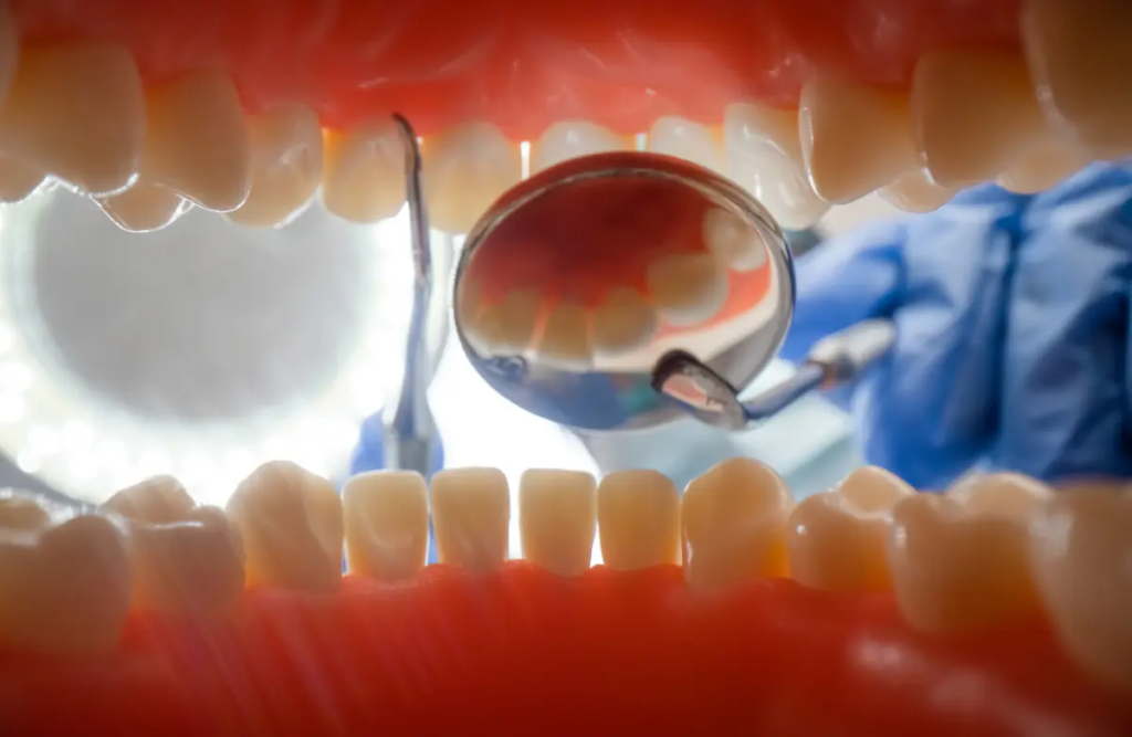 An inside view of a mouth that may or may not need a full mouth restoration